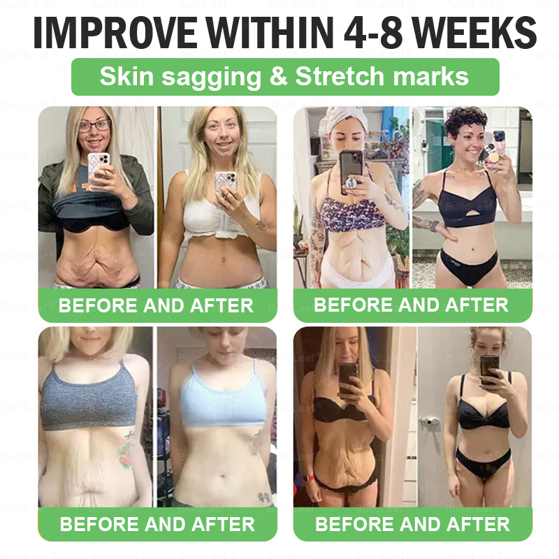🌿🎁🎁𝑩𝒖𝒊𝒍𝒅𝑳𝒆𝒂𝒇® 𝑶𝒏𝒍𝒚 5 𝒃𝒐𝒙𝒆𝒔!!!!! 𝑮𝒓𝒂𝒃 𝒂𝒏 𝒆𝒙𝒄𝒍𝒖𝒔𝒊𝒗𝒆 50% 𝒅𝒊𝒔𝒄𝒐𝒖𝒏𝒕 𝒏𝒐𝒘! 𝑲𝒆𝒆𝒑 𝒚𝒐𝒖 𝒉𝒆𝒂𝒍𝒕𝒉𝒚 𝒂𝒏𝒅 𝒊𝒎𝒑𝒓𝒐𝒗𝒊𝒏𝒈 𝒊𝒏 𝒋𝒖𝒔𝒕 1 𝒕𝒐 4 𝒘𝒆𝒆𝒌𝒔. 𝑫𝒐𝒏’𝒕 𝒎𝒊𝒔𝒔 𝒚𝒐𝒖𝒓 𝒄𝒉𝒂𝒏𝒄𝒆—𝒕𝒉𝒊𝒔 𝒐𝒇𝒇𝒆𝒓 𝒘𝒐𝒏’𝒕 𝒄𝒐𝒎𝒆 𝒂𝒓𝒐𝒖𝒏𝒅 𝒂𝒈𝒂𝒊𝒏 𝒖𝒏𝒕𝒊𝒍 𝒏𝒆𝒙𝒕 𝒚𝒆𝒂𝒓. 𝑨𝒄𝒕 𝒇𝒂𝒔𝒕! 180-𝒅𝒂𝒚 𝒎𝒐𝒏𝒆𝒚 𝒃𝒂𝒄𝒌 𝒈𝒖𝒂𝒓𝒂𝒏𝒕𝒆𝒆!