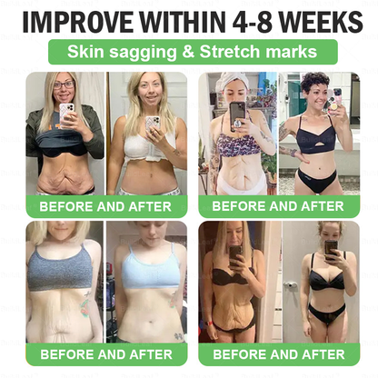 🌿🎁🎁𝑩𝒖𝒊𝒍𝒅𝑳𝒆𝒂𝒇® 𝑶𝒏𝒍𝒚 5 𝒃𝒐𝒙𝒆𝒔!!!!! 𝑮𝒓𝒂𝒃 𝒂𝒏 𝒆𝒙𝒄𝒍𝒖𝒔𝒊𝒗𝒆 50% 𝒅𝒊𝒔𝒄𝒐𝒖𝒏𝒕 𝒏𝒐𝒘! 𝑲𝒆𝒆𝒑 𝒚𝒐𝒖 𝒉𝒆𝒂𝒍𝒕𝒉𝒚 𝒂𝒏𝒅 𝒊𝒎𝒑𝒓𝒐𝒗𝒊𝒏𝒈 𝒊𝒏 𝒋𝒖𝒔𝒕 1 𝒕𝒐 4 𝒘𝒆𝒆𝒌𝒔. 𝑫𝒐𝒏’𝒕 𝒎𝒊𝒔𝒔 𝒚𝒐𝒖𝒓 𝒄𝒉𝒂𝒏𝒄𝒆—𝒕𝒉𝒊𝒔 𝒐𝒇𝒇𝒆𝒓 𝒘𝒐𝒏’𝒕 𝒄𝒐𝒎𝒆 𝒂𝒓𝒐𝒖𝒏𝒅 𝒂𝒈𝒂𝒊𝒏 𝒖𝒏𝒕𝒊𝒍 𝒏𝒆𝒙𝒕 𝒚𝒆𝒂𝒓. 𝑨𝒄𝒕 𝒇𝒂𝒔𝒕! 180-𝒅𝒂𝒚 𝒎𝒐𝒏𝒆𝒚 𝒃𝒂𝒄𝒌 𝒈𝒖𝒂𝒓𝒂𝒏𝒕𝒆𝒆!