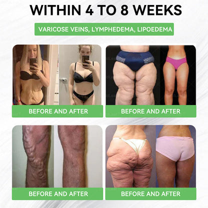 🌿🎁🎁𝑩𝒖𝒊𝒍𝒅𝑳𝒆𝒂𝒇® 𝑶𝒏𝒍𝒚 5 𝒃𝒐𝒙𝒆𝒔!!!!! 𝑮𝒓𝒂𝒃 𝒂𝒏 𝒆𝒙𝒄𝒍𝒖𝒔𝒊𝒗𝒆 50% 𝒅𝒊𝒔𝒄𝒐𝒖𝒏𝒕 𝒏𝒐𝒘! 𝑲𝒆𝒆𝒑 𝒚𝒐𝒖 𝒉𝒆𝒂𝒍𝒕𝒉𝒚 𝒂𝒏𝒅 𝒊𝒎𝒑𝒓𝒐𝒗𝒊𝒏𝒈 𝒊𝒏 𝒋𝒖𝒔𝒕 1 𝒕𝒐 4 𝒘𝒆𝒆𝒌𝒔. 𝑫𝒐𝒏’𝒕 𝒎𝒊𝒔𝒔 𝒚𝒐𝒖𝒓 𝒄𝒉𝒂𝒏𝒄𝒆—𝒕𝒉𝒊𝒔 𝒐𝒇𝒇𝒆𝒓 𝒘𝒐𝒏’𝒕 𝒄𝒐𝒎𝒆 𝒂𝒓𝒐𝒖𝒏𝒅 𝒂𝒈𝒂𝒊𝒏 𝒖𝒏𝒕𝒊𝒍 𝒏𝒆𝒙𝒕 𝒚𝒆𝒂𝒓. 𝑨𝒄𝒕 𝒇𝒂𝒔𝒕! 180-𝒅𝒂𝒚 𝒎𝒐𝒏𝒆𝒚 𝒃𝒂𝒄𝒌 𝒈𝒖𝒂𝒓𝒂𝒏𝒕𝒆𝒆!