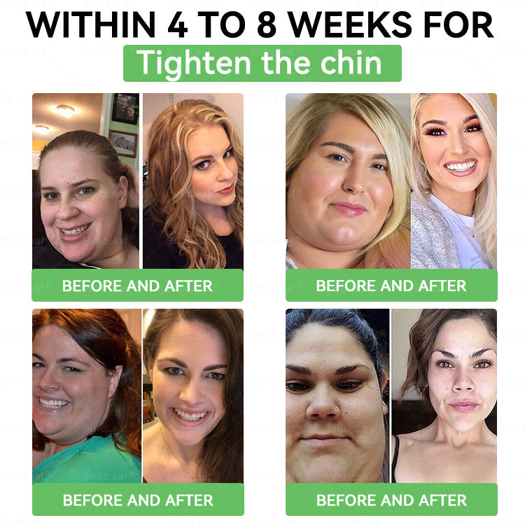 🌿🎁🎁𝑩𝒖𝒊𝒍𝒅𝑳𝒆𝒂𝒇® 𝑶𝒏𝒍𝒚 5 𝒃𝒐𝒙𝒆𝒔!!!!! 𝑮𝒓𝒂𝒃 𝒂𝒏 𝒆𝒙𝒄𝒍𝒖𝒔𝒊𝒗𝒆 50% 𝒅𝒊𝒔𝒄𝒐𝒖𝒏𝒕 𝒏𝒐𝒘! 𝑲𝒆𝒆𝒑 𝒚𝒐𝒖 𝒉𝒆𝒂𝒍𝒕𝒉𝒚 𝒂𝒏𝒅 𝒊𝒎𝒑𝒓𝒐𝒗𝒊𝒏𝒈 𝒊𝒏 𝒋𝒖𝒔𝒕 1 𝒕𝒐 4 𝒘𝒆𝒆𝒌𝒔. 𝑫𝒐𝒏’𝒕 𝒎𝒊𝒔𝒔 𝒚𝒐𝒖𝒓 𝒄𝒉𝒂𝒏𝒄𝒆—𝒕𝒉𝒊𝒔 𝒐𝒇𝒇𝒆𝒓 𝒘𝒐𝒏’𝒕 𝒄𝒐𝒎𝒆 𝒂𝒓𝒐𝒖𝒏𝒅 𝒂𝒈𝒂𝒊𝒏 𝒖𝒏𝒕𝒊𝒍 𝒏𝒆𝒙𝒕 𝒚𝒆𝒂𝒓. 𝑨𝒄𝒕 𝒇𝒂𝒔𝒕! 180-𝒅𝒂𝒚 𝒎𝒐𝒏𝒆𝒚 𝒃𝒂𝒄𝒌 𝒈𝒖𝒂𝒓𝒂𝒏𝒕𝒆𝒆!