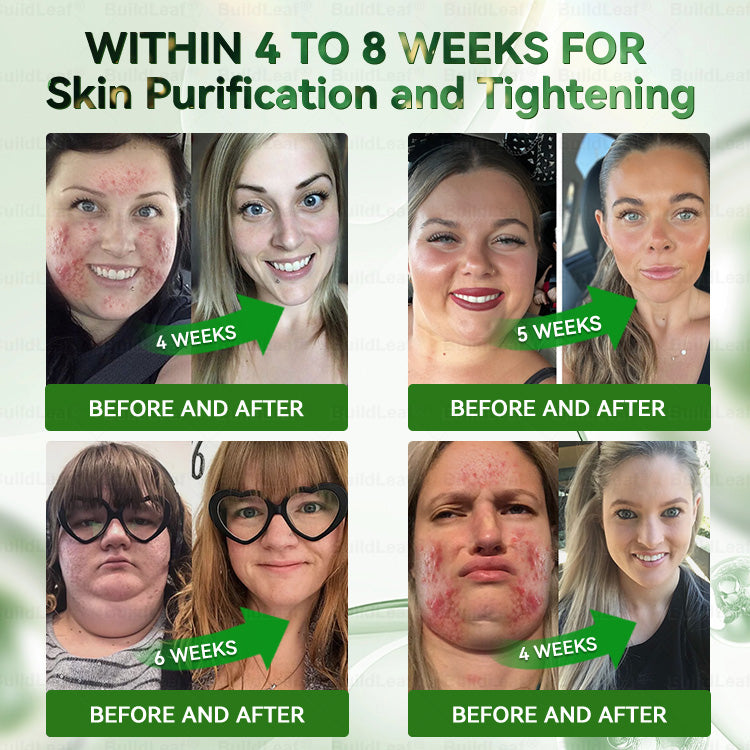 𝐀𝐬 𝐚 𝐥𝐮𝐜𝐤𝐲 𝐜𝐮𝐬𝐭𝐨𝐦𝐞𝐫, 𝐲𝐨𝐮 𝐡𝐚𝐯𝐞 𝐨𝐧𝐞 𝐦𝐨𝐫𝐞 𝐜𝐡𝐚𝐧𝐜𝐞 𝐭𝐨 𝐞𝐧𝐣𝐨𝐲 𝐚 𝟓𝟎% 𝐝𝐢𝐬𝐜𝐨𝐮𝐧𝐭 𝐨𝐧 𝐲𝐨𝐮𝐫 𝐧𝐞𝐱𝐭 𝐬𝐡𝐨𝐩𝐩𝐢𝐧𝐠 𝐬𝐩𝐫𝐞𝐞!     𝐁𝐮𝐢𝐥𝐝𝐋𝐞𝐚𝐟®