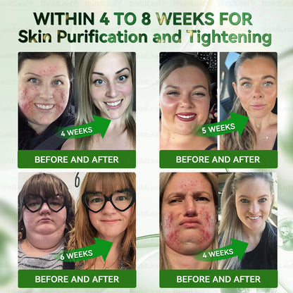 𝐀𝐬 𝐚 𝐥𝐮𝐜𝐤𝐲 𝐜𝐮𝐬𝐭𝐨𝐦𝐞𝐫, 𝐲𝐨𝐮 𝐡𝐚𝐯𝐞 𝐨𝐧𝐞 𝐦𝐨𝐫𝐞 𝐜𝐡𝐚𝐧𝐜𝐞 𝐭𝐨 𝐞𝐧𝐣𝐨𝐲 𝐚 𝟓𝟎% 𝐝𝐢𝐬𝐜𝐨𝐮𝐧𝐭 𝐨𝐧 𝐲𝐨𝐮𝐫 𝐧𝐞𝐱𝐭 𝐬𝐡𝐨𝐩𝐩𝐢𝐧𝐠 𝐬𝐩𝐫𝐞𝐞!     𝐁𝐮𝐢𝐥𝐝𝐋𝐞𝐚𝐟®